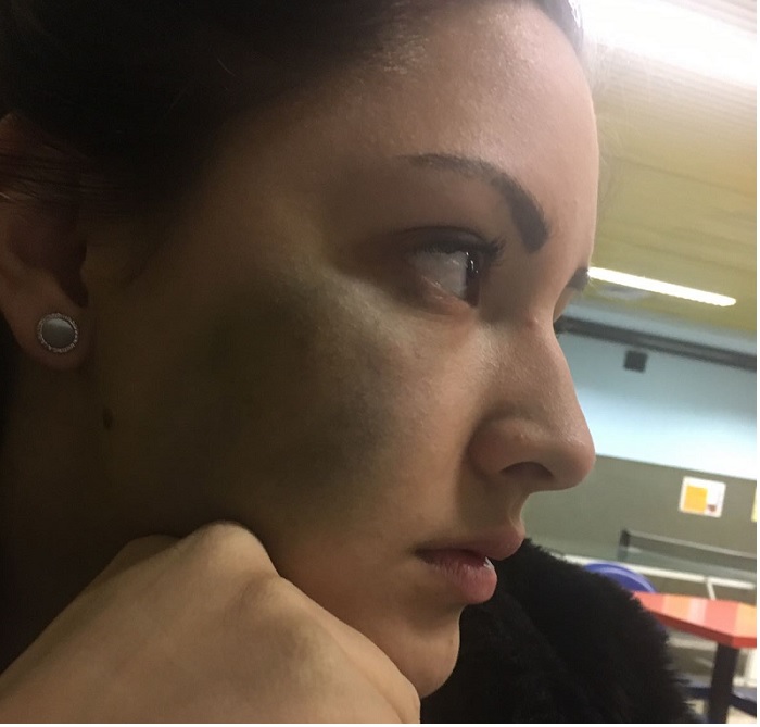 Aggredita senza motivo sulla soglia di casa
