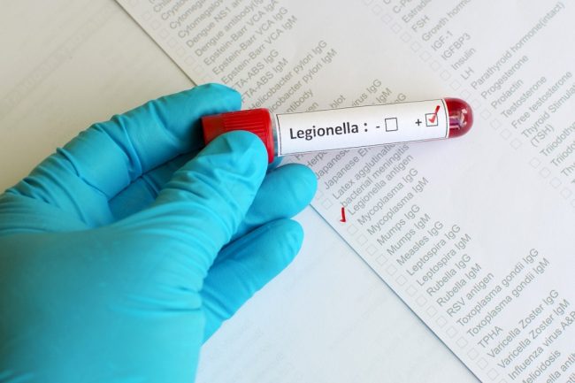Legionella Lombardia: tre morti, ma il batterio non è nell’acquedotto