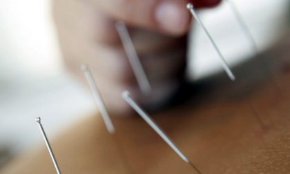 Quando l'agopuntura è abusiva: scoperto falso medico