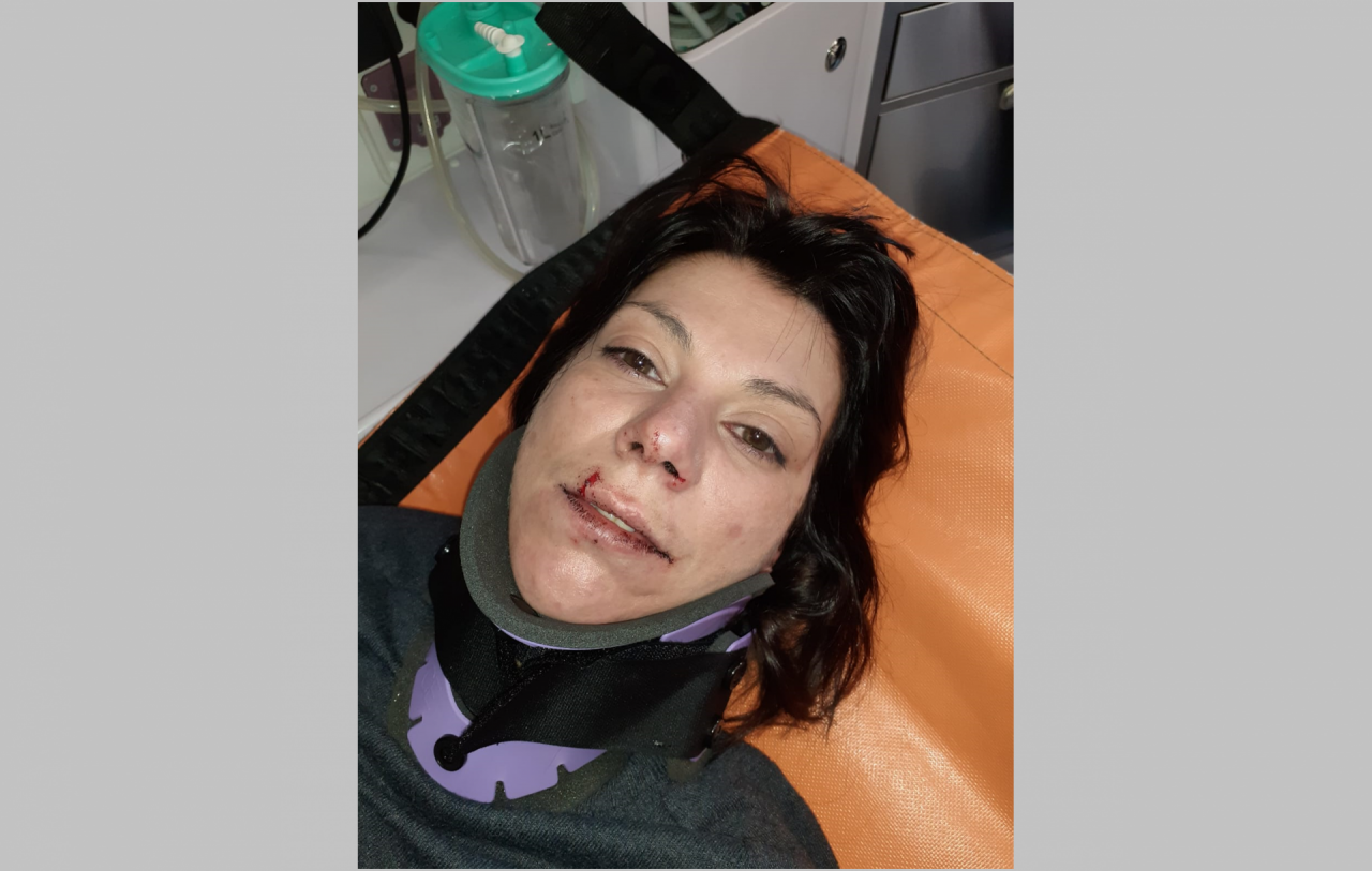 Donna aggredita per un parcheggio: “Ho rischiato di morire”