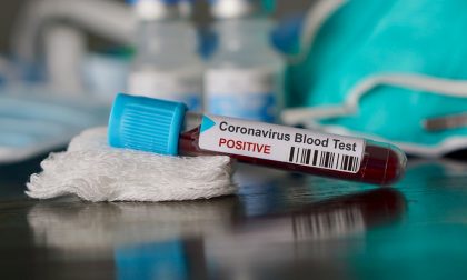 Coronavirus Lombardia, secondo giorno con meno di 100 morti, ma a Milano ancora troppi contagi I NUMERI