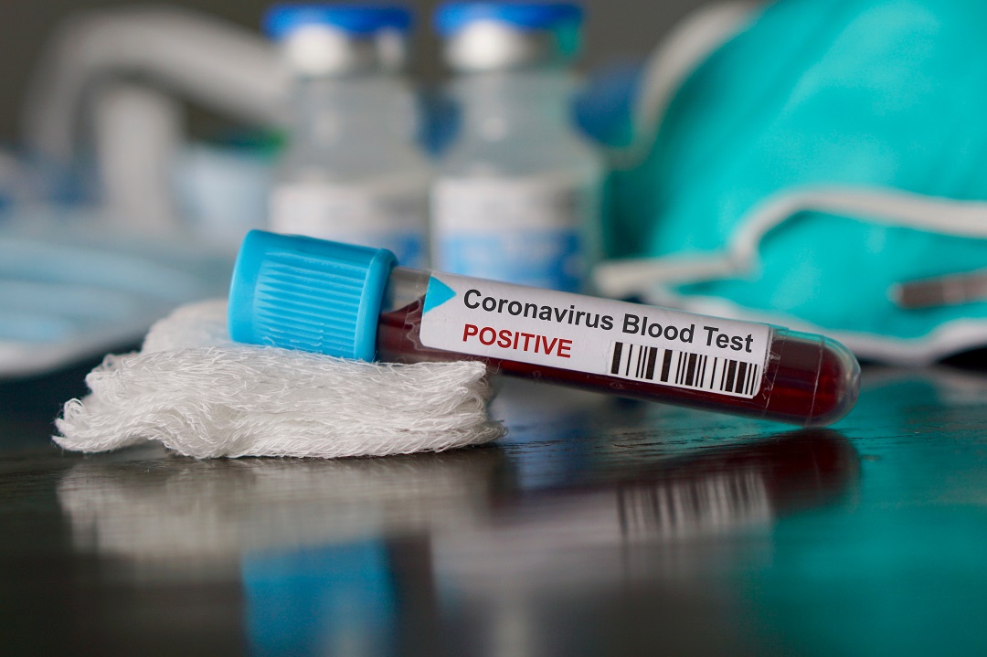 Coronavirus Lombardia, secondo giorno con meno di 100 morti, ma a Milano ancora troppi contagi I NUMERI