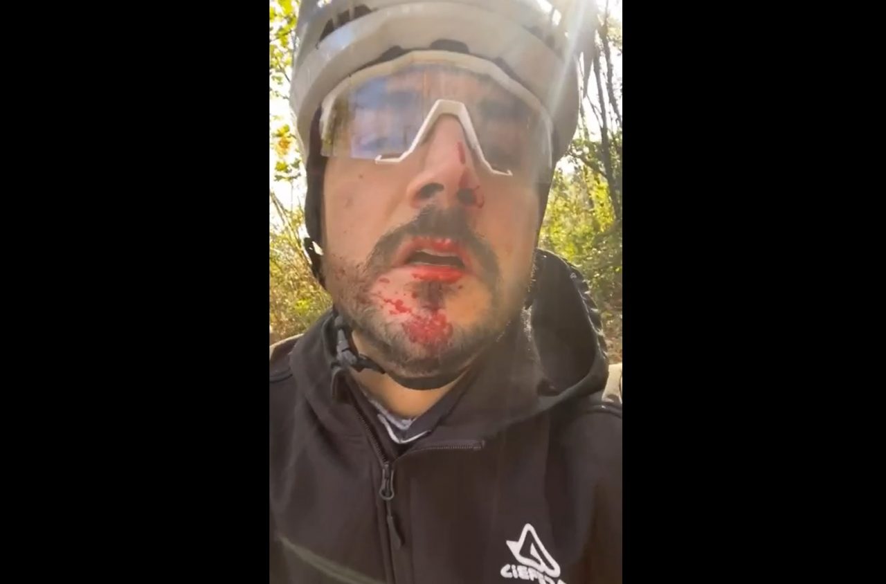 Filo spinato sul sentiero:  ciclista ferito sui colli di Città Alta VIDEO