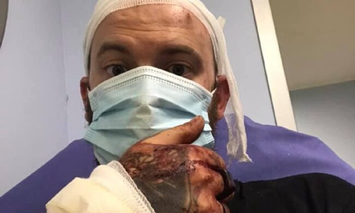 Chiede a due clienti di non fare chiasso: barista pestato a sangue