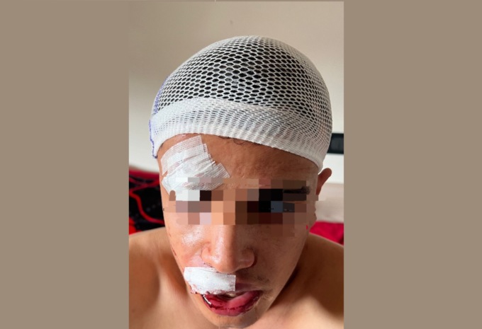 Aggredito e pestato fuori dalla discoteca