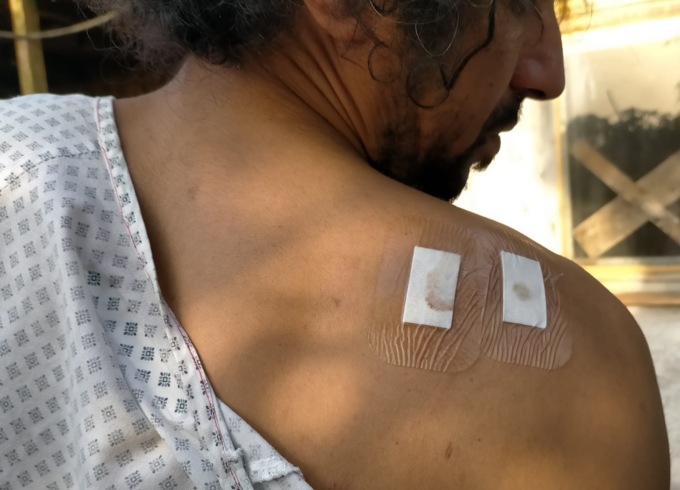 Parla l’uomo gambizzato a Caravaggio: “È stato un commando”