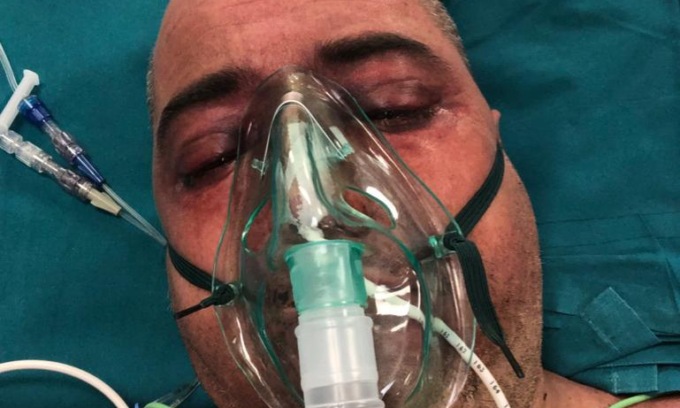 Rimasto invalido in un incidente sul lavoro, ora sopravvive con un’indennità da 800 euro