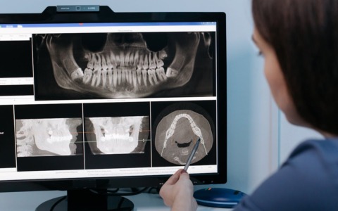 Tecnologia e cura dentale: un nuovo modo di vivere la prevenzione