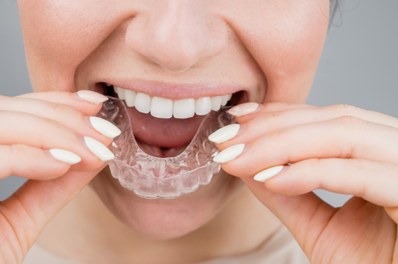 Ortodonzia invisibile: il dottor Piacentini spiega come funziona